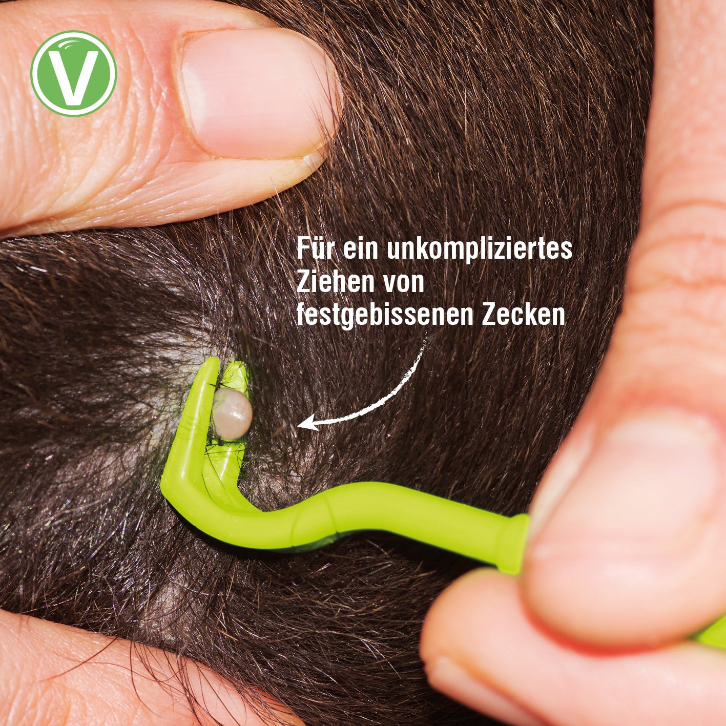 Vetlando-Zeckenhaken-3er-5